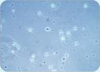 Samenfäden (Spermien) unter dem Mikroskop