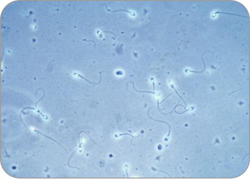 Spermien mikroskop 12 faszinierende
